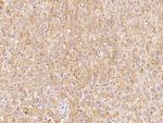 ABH1 Antibody in Immunohistochemistry (Paraffin) (IHC (P))