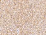 ABH1 Antibody in Immunohistochemistry (Paraffin) (IHC (P))