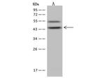 ABH1 Antibody in Western Blot (WB)