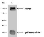 CD13 Antibody in Immunoprecipitation (IP)