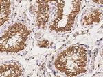 Annexin A6 Antibody in Immunohistochemistry (Paraffin) (IHC (P))