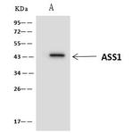 ASS1 Antibody in Immunoprecipitation (IP)