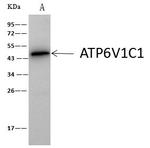 V-ATPase C1 Antibody in Immunoprecipitation (IP)