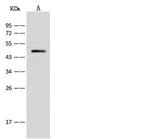 V-ATPase C1 Antibody in Western Blot (WB)