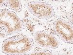 Ataxin 3 Antibody in Immunohistochemistry (Paraffin) (IHC (P))