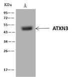 Ataxin 3 Antibody in Immunoprecipitation (IP)