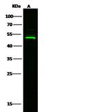 BLMH Antibody in Western Blot (WB)