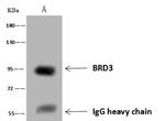 BRD3 Antibody in Immunoprecipitation (IP)