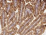 C1QBP Antibody in Immunohistochemistry (Paraffin) (IHC (P))