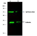 Calbindin Antibody in Immunoprecipitation (IP)