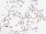 CAPG Antibody in Immunohistochemistry (Paraffin) (IHC (P))