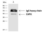 CAPG Antibody in Immunoprecipitation (IP)