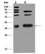 Caspase 7 Antibody in Western Blot (WB)