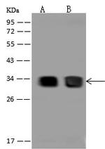 CBR1 Antibody in Western Blot (WB)