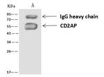 CD2AP Antibody in Immunoprecipitation (IP)
