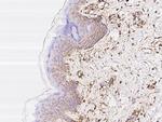 CD44 Antibody in Immunohistochemistry (Paraffin) (IHC (P))