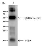 CD59 Antibody in Immunoprecipitation (IP)