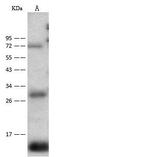 CD59 Antibody in Western Blot (WB)