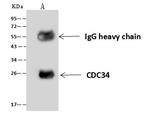 Cdc34 Antibody in Immunoprecipitation (IP)