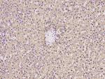 CES1 Antibody in Immunohistochemistry (Paraffin) (IHC (P))