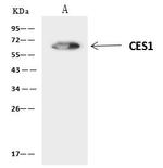 CES1 Antibody in Immunoprecipitation (IP)