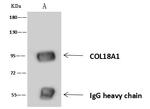 Endostatin Antibody in Immunoprecipitation (IP)