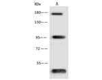 Endostatin Antibody in Western Blot (WB)