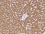 CPS1 Antibody in Immunohistochemistry (Paraffin) (IHC (P))