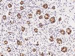 CPS1 Antibody in Immunohistochemistry (Paraffin) (IHC (P))