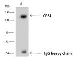 CPS1 Antibody in Immunoprecipitation (IP)
