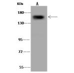 CPS1 Antibody in Western Blot (WB)