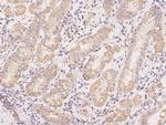 CSK Antibody in Immunohistochemistry (Paraffin) (IHC (P))