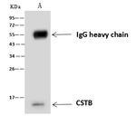 Cystatin B Antibody in Immunoprecipitation (IP)