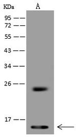 Cystatin B Antibody in Western Blot (WB)