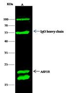 CXCL1 Antibody in Immunoprecipitation (IP)