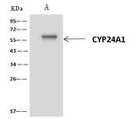 CYP24A1 Antibody in Immunoprecipitation (IP)