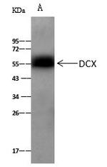 Doublecortin Antibody in Immunoprecipitation (IP)