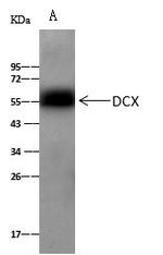 Doublecortin Antibody in Immunoprecipitation (IP)