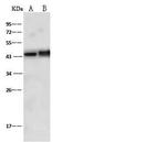 Doublecortin Antibody in Western Blot (WB)