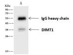 DIMT1 Antibody in Immunoprecipitation (IP)