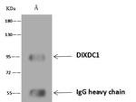 DIXDC1 Antibody in Immunoprecipitation (IP)