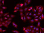 CRMP2 Antibody in Immunocytochemistry (ICC/IF)