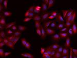 CRMP2 Antibody in Immunocytochemistry (ICC/IF)