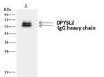 CRMP2 Antibody in Immunoprecipitation (IP)