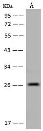 DTYMK Antibody in Western Blot (WB)