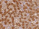 ECHDC1 Antibody in Immunohistochemistry (Paraffin) (IHC (P))