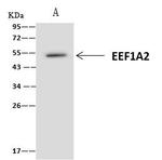 EEF1A2 Antibody in Immunoprecipitation (IP)
