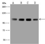 EEF2K Antibody in Western Blot (WB)