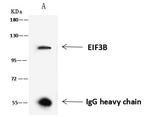 eIF3b Antibody in Immunoprecipitation (IP)