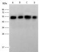 NSE Antibody in Western Blot (WB)